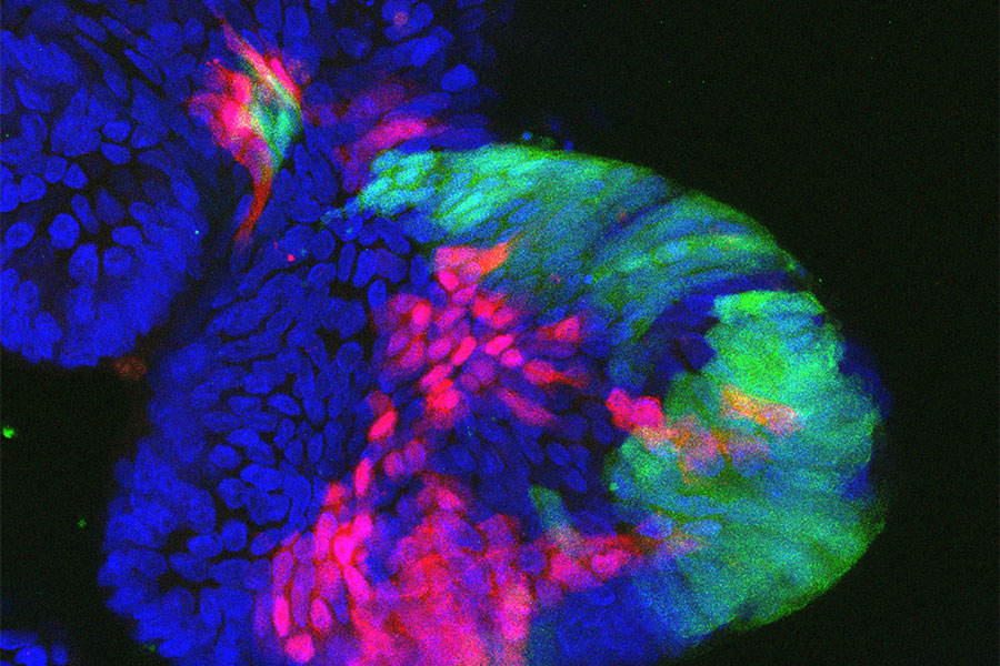 Konfokales Mikroskopiebild von Zellen in humanen Darm­Organoiden: Nach lentiviraler Markierung (grün oder rot fluoreszierendes Protein) können einzelne Zellklone verfolgt werden. Der blaue Farbstoff markiert alle Zellkerne. Das Einbringen von Genscheren (CRISPR/Cas9) erlaubt dann die Untersuchung von TumorSuppressorgenen.
