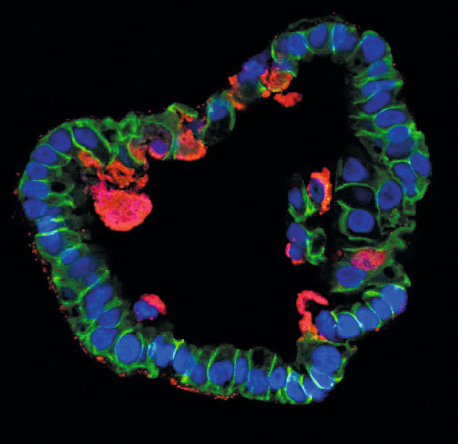 Mikroskopieaufnahme eines Eileiterorganoids im Querschnitt. Die mit Chlamydien infizierten Bereiche (rot) sind gut zu erkennen.