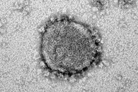 Das neue Coronavirus, SARS-CoV-2, ist Gegenstand von zwei neuen BMBF-Förderprojekten an der Universität Ulm 