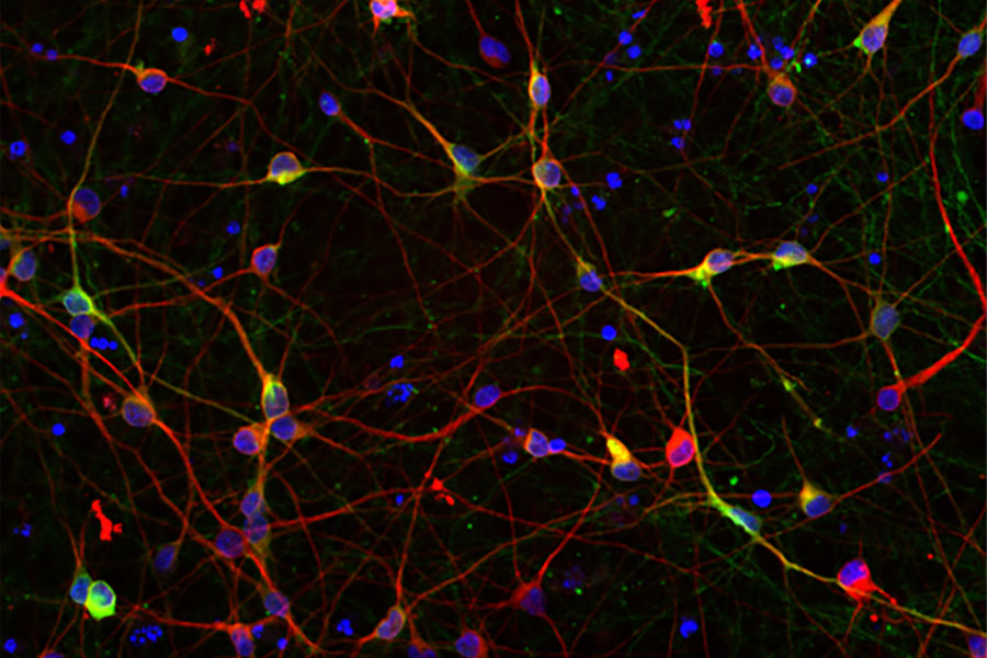 Auf dem Mikroskopie­-Bild sind in Rot Neuronen und in Blau Zellkerne zu erkennen. Die Überlagerung mit Grün zeigt Dopamin erzeugende Neuronen an. Dieser Zelltyp ist maßgeblich von Parkinson betroffen.