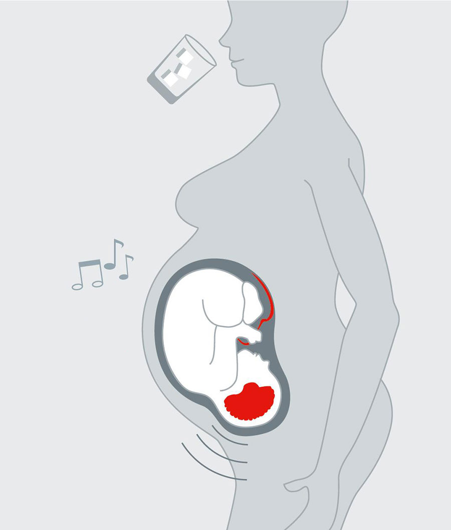 Bei Schwangerschaftsdiabetes ist die Hirnreaktion des Fötus auf präsentierte Töne nach einer Mahlzeit der Mutter verlangsamt. 