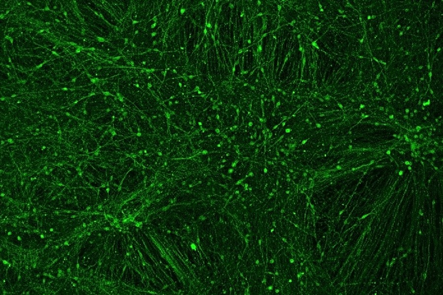 In der Petrischale hergestellte menschliche Neuronen, die in der genannten Studie als Modellsystem zum Studium der genetischen Varianten eingesetzt wurden.