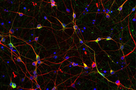 Auf dem Mikroskopie­Bild sind in Rot Neuronen und in Blau Zellkerne zu erkennen. Die Überlagerung mit Grün zeigt Dopamin erzeugende Neuronen an. 