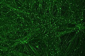 In der Petrischale hergestellte menschliche Neuronen, die in der genannten Studie als Modellsystem zum Studium der genetischen Varianten eingesetzt wurden.